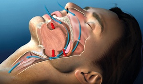 upper airway