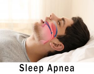 Snoring man with animation of airway